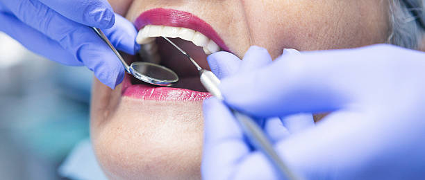 Best Emergency Dental Care for Broken or Chipped Teeth in Centralia, MO